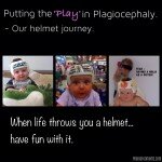 Louise and Mason’s plagiocephaly helmet story