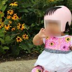 My Experience with Plagiocephaly and Torticollis