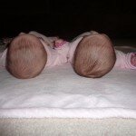 My Twins and Their Plagiocephaly Helmet Story